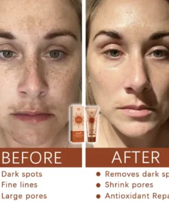 AEXZR® Herbal Spots Peel-Off Facial Mask