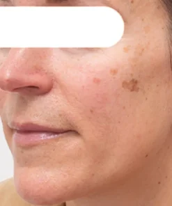 AEXZR® Herbal Spots Peel-Off Facial Mask