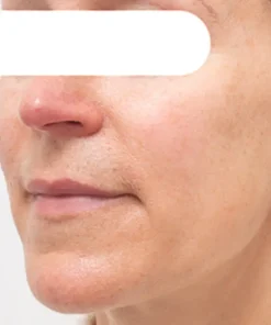 AEXZR® Herbal Spots Peel-Off Facial Mask