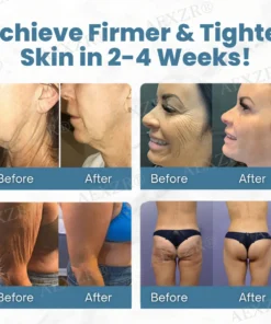AEXZR® Anti-Wrinkle Skin Cream