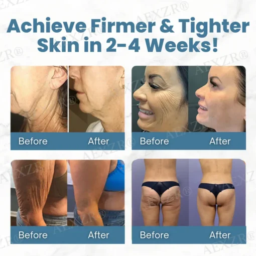AEXZR® Anti-Wrinkle Skin Cream