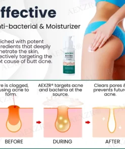 AEXZR® Butt Skin Treatment Cream