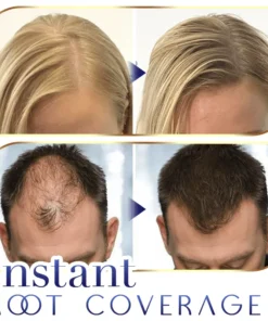 Aexzr™ Premium Hairline Coverage Touch Up Powder
