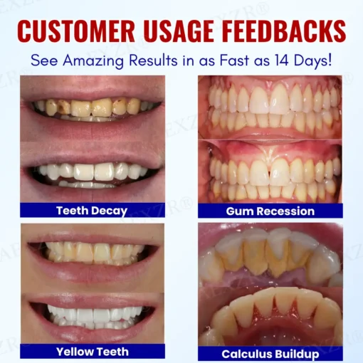 AEXZR® Baking Soda Oral Health Toothpaste