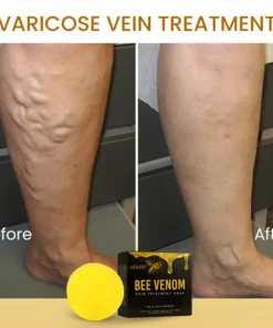 AEXZR® Bee Venom Skin Treatment Soap