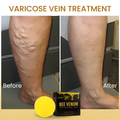 AEXZR® Bee Venom Skin Treatment Soap