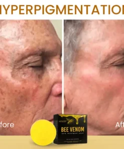AEXZR® Bee Venom Skin Treatment Soap
