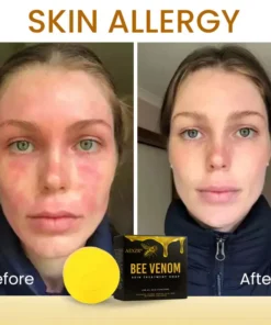 AEXZR® Bee Venom Skin Treatment Soap
