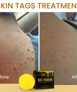 AEXZR® Bee Venom Skin Treatment Soap