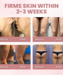 AEXZR® Body Skin Firming Cream