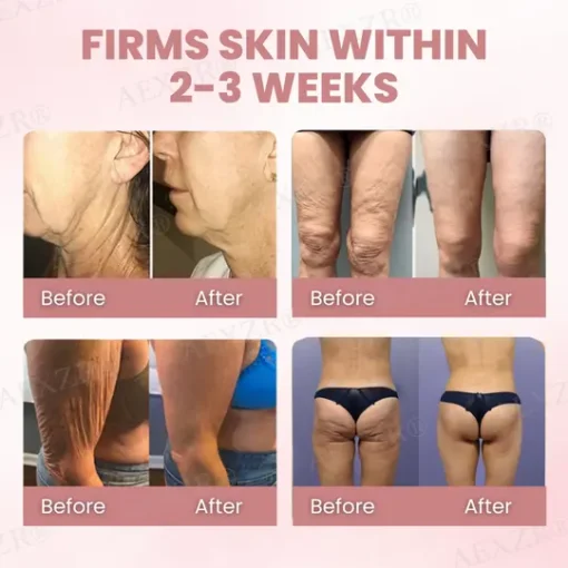 AEXZR® Body Skin Firming Cream