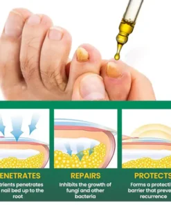 AEXZR® Fungal Nail Treatment