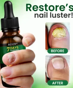 AEXZR® Fungal Nail Treatment