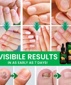 AEXZR® Fungal Nail Treatment
