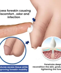AEXZR® Glans Whitening & Foreskin Corrector Cream