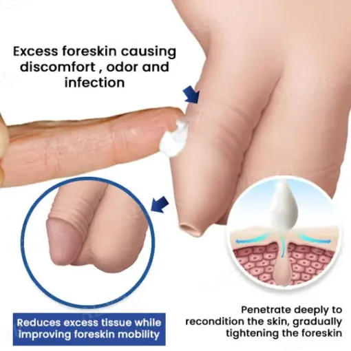 AEXZR® Glans Whitening & Foreskin Corrector Cream