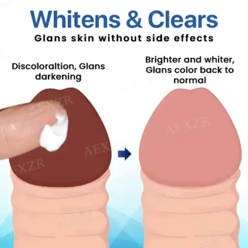 AEXZR® Glans Whitening & Foreskin Corrector Cream