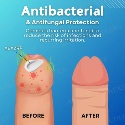 AEXZR® Glans and Foreskin Care Cream