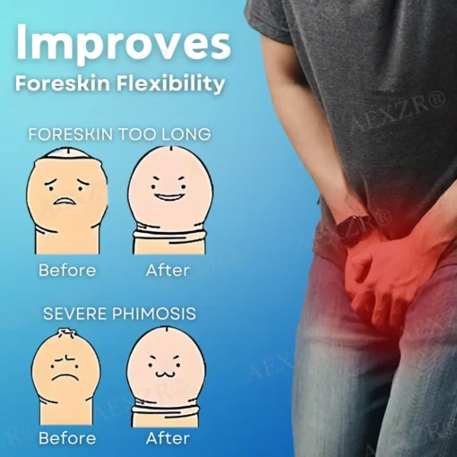 AEXZR® Glans and Foreskin Care Cream