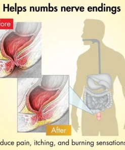 AEXZR™ Hemorrhoid-Relief Cream
