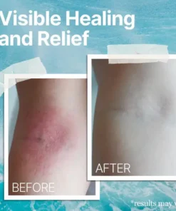 AEXZR® Ocean Healed Eczema Soothing Cream