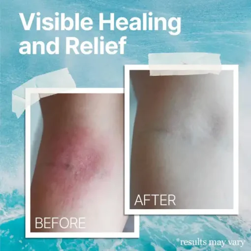AEXZR® Ocean Healed Eczema Soothing Cream