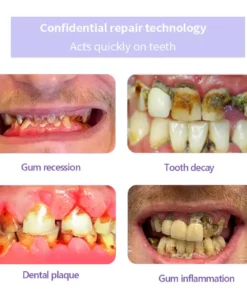 AEXZR® Teeth Restoration Mineral Powder