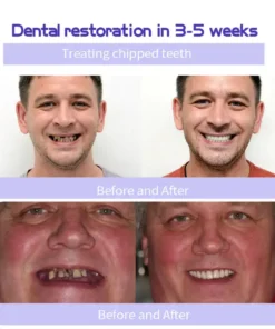 AEXZR® Teeth Restoration Mineral Powder