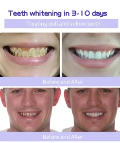 AEXZR® Teeth Restoration Mineral Powder