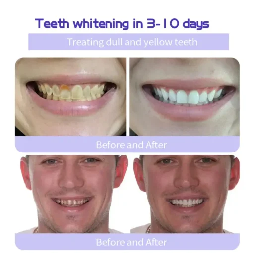 AEXZR® Teeth Restoration Mineral Powder