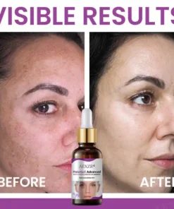 AEXZR® MelantaX Advanced Anti-Hyperpigmentation Essence