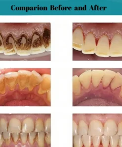 AEXZR® Oral Calculus Suppressant