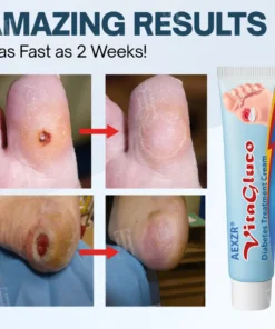 AEXZR® VitaGluco Diabetes Treatment Cream