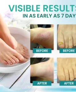 AEXZR® ItchBreak Sea Salt Soak