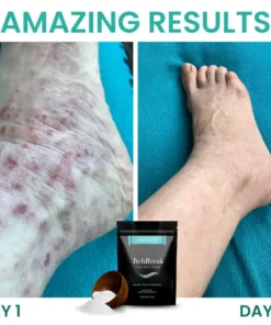 AEXZR® ItchBreak Sea Salt Soak