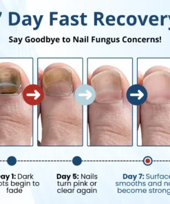 AEXZR® MycoShield Pro Fungal Nail Patches