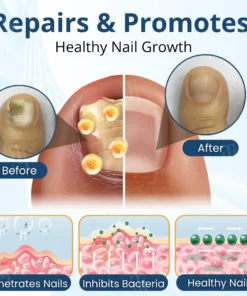 AEXZR® MycoShield Pro Fungal Nail Patches