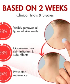 AEXZR® Nano-Microdart Skin Tag & Spot Corrector Patches