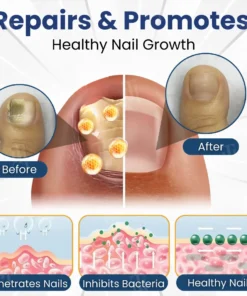 AEXZR® Bio-Active Deep Penetration System for Nail Fungus