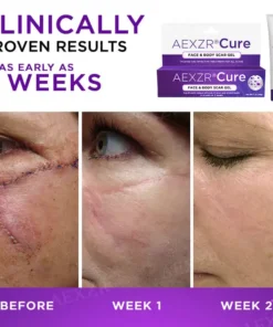 AEXZR® Cure Face & Body Scar Gel