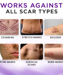 AEXZR® Cure Face & Body Scar Gel