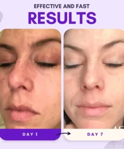 AEXZR® Thiamidol 630 Serum