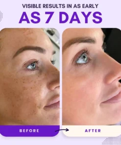 AEXZR® Thiamidol 630 Serum