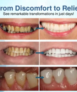 AEXZR® Dental Pulp Repair Regeneration.