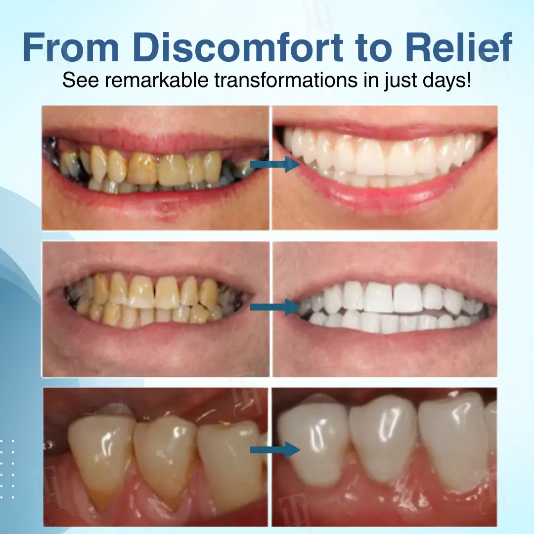 AEXZR® Dental Pulp Repair Regeneration.