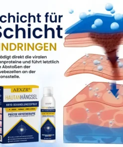 AEXZR® Hautanhängsel-Kryo-Behandlungsspray