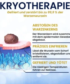 AEXZR® Hautanhängsel-Kryo-Behandlungsspray