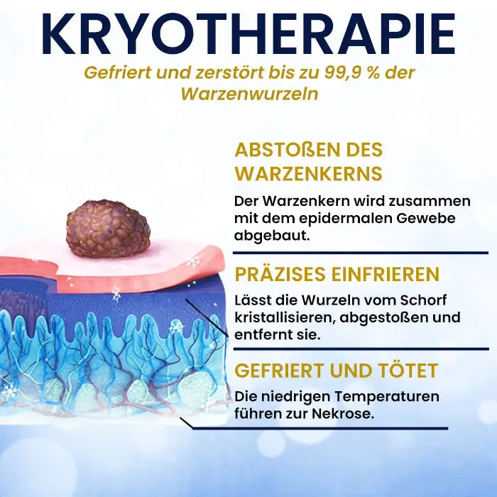 AEXZR® Hautanhängsel-Kryo-Behandlungsspray
