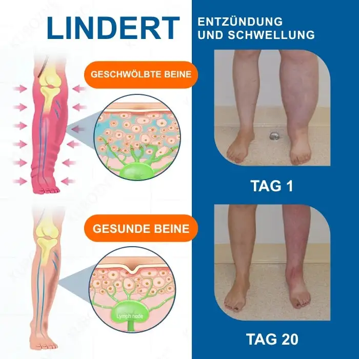 AEXZR® LYMPHÖDEM-Drainage-Massagecreme