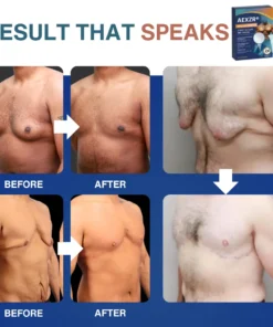 AEXZR® Nano-Microneedle Chest-Sculpt Bio-Patch (𝐉𝐮𝐬𝐭 𝐨𝐧𝐜𝐞 𝐚 𝐝𝐚𝐲, 𝐯𝐢𝐬𝐢𝐛𝐥𝐞 𝐜𝐡𝐚𝐧𝐠𝐞𝐬 𝐢𝐧 𝟕 𝑫𝐚𝐲𝐬 𝐅𝐨𝐫 𝐆𝐲𝐧𝐞𝐜𝐨𝐦𝐚𝐬𝐭𝐢𝐚, 𝐄𝐱𝐜𝐞𝐬𝐬 𝐂𝐡𝐞𝐬𝐭 𝐅𝐚𝐭, 𝐒𝐚𝐠𝐠𝐢𝐧𝐠 𝐒𝐤𝐢𝐧, 𝙇𝙊𝙊𝙎𝗘 𝗦𝗞𝗜𝗡, 𝐚𝐧𝐝 𝐦𝐨𝐫𝐞